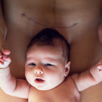 Mehr als Medizin: 7 Schichten, dann ist dein Baby da! #Kaiserschnitt Bauchgeburt